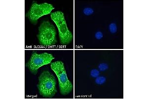 Immunofluorescence (IF) image for anti-Solute Carrier Family 6 (Neurotransmitter Transporter, serotonin), Member 4 (SLC6A4) (Internal Region) antibody (ABIN185394)