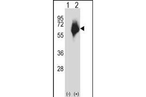 Western blot analysis of P2 (arrow) using rabbit polyclonal P2 Antibody (Center) (ABIN657616 and ABIN2846612).