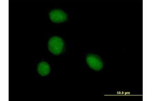 Immunofluorescence of purified MaxPab antibody to ZBTB6 on HeLa cell. (ZBTB6 抗体  (AA 1-424))