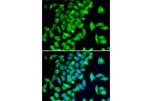 Immunofluorescence analysis of  cells using TPH2 antibody (ABIN6133469, ABIN6149436, ABIN6149437 and ABIN6222965). (Tryptophan Hydroxylase 2 抗体  (AA 1-170))
