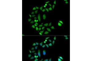 Immunofluorescence analysis of MCF7 cells using CLIC1 Polyclonal Antibody (CLIC1 抗体)