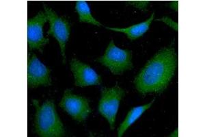 ICC/IF analysis of NAGK in HeLa cells line, stained with DAPI (Blue) for nucleus staining and monoclonal anti-human NAGK antibody (1:100) with goat anti-mouse IgG-Alexa fluor 488 conjugate (Green). (NAGK 抗体  (AA 1-344))