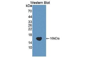 Western blot analysis of the recombinant protein. (ADAMTS1 抗体  (AA 854-967))