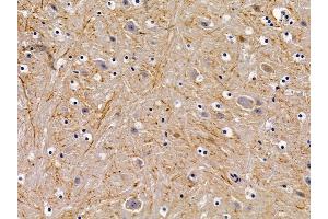 ABIN6258928 and ABIN6276017 at 1/100 staining mouse brain tissue by IHC-P. (GPR156 抗体  (Internal Region))