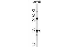 Western Blotting (WB) image for anti-Interleukin 17 Receptor C (IL17RC) antibody (ABIN3000332) (IL17RC 抗体)