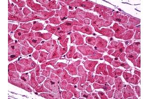 Anti-Podoplanin antibody IHC of human heart. (Podoplanin 抗体  (AA 1-206))