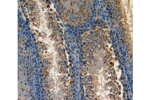 Used in DAB staining on fromalin fixed paraffin-embedded Kidney tissue (AATK 抗体  (AA 137-386))