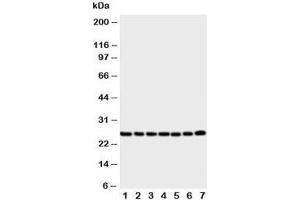 Western blot testing of SIP antibody and Lane 1:  rat liver ;  2: (r) brain;  3: (r) spleen;  4: human SMMC-7721;  5: (h) COLO320;  6: (h) SW620;  7: (h) 293T cell lysate (CACYBP 抗体  (Middle Region))