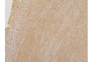 IHC analysis of LMTK3 using anti-LMTK3 antibody (ABIN6719386).