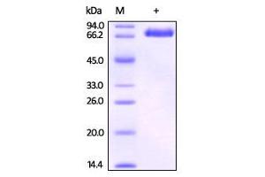 SDS-PAGE (SDS) image for EPH Receptor B4 (EPHB4) (AA 16-539) protein (His tag,Biotin) (ABIN2444108)