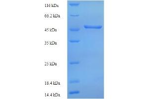SDS-PAGE (SDS) image for Hemagglutinin Esterase (HE) (AA 19-424) protein (His tag) (ABIN5714060)