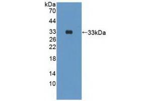 Detection of Recombinant PIK3Cd, Human using Polyclonal Antibody to Phosphoinositide-3-Kinase Catalytic Delta Polypeptide (PIK3Cd) (PIK3CD 抗体  (AA 774-1044))