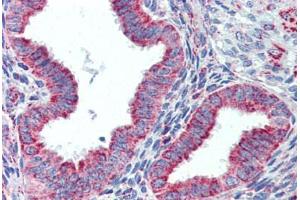 Human Uterus (formalin-fixed, paraffin-embedded) stained with HSPD1 antibody ABIN462365 followed by biotinylated anti-goat IgG secondary antibody ABIN481715, alkaline phosphatase-streptavidin and chromogen. (HSPD1 抗体)