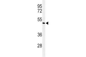 Western blot analysis of SMAD7 antibody in ZR-75-1 lysate. (SMAD7 抗体  (AA 195-224))