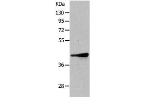 Western Blot analysis of Human fetal muscle tissue using TRIM63 Polyclonal Antibody at dilution of 1:1050 (TRIM63 抗体)