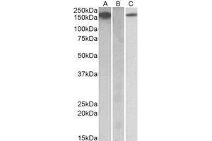 Western Blotting (WB) image for anti-Colony Stimulating Factor 1 Receptor (CSF1R) (Internal Region) antibody (ABIN2464716) (CSF1R 抗体  (Internal Region))