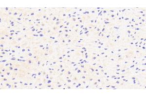 Detection of CFI in Human Cardiac Muscle Tissue using Polyclonal Antibody to Complement Factor I (CFI) (Complement Factor I 抗体  (AA 28-243))