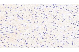 Detection of CFI in Human Cardiac Muscle Tissue using Polyclonal Antibody to Complement Factor I (CFI) (Complement Factor I 抗体  (AA 28-243))