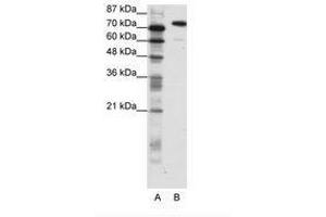 Image no. 1 for anti-SATB Homeobox 1 (SATB1) (C-Term) antibody (ABIN202904) (SATB1 抗体  (C-Term))