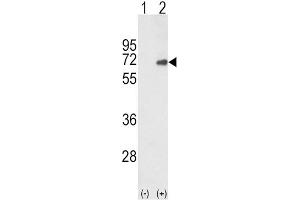 Western Blotting (WB) image for anti-SMAD Family Member 4 (SMAD4) antibody (ABIN3003471) (SMAD4 抗体)
