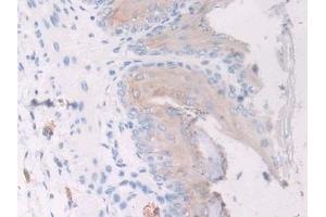 Immunohistochemistry (IHC) image for anti-Cyclin-Dependent Kinase 1 (CDK1) (AA 59-181) antibody (ABIN7438382)