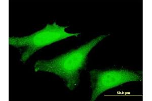 Immunofluorescence of monoclonal antibody to SVIL on HeLa cell. (Supervillin 抗体  (AA 1679-1786))