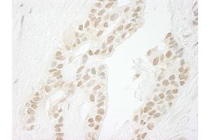 Immunohistochemistry (IHC) image for anti-Protein Phosphatase 1, Catalytic Subunit, gamma Isoform (PPP1CC) (C-Term) antibody (ABIN7448737)