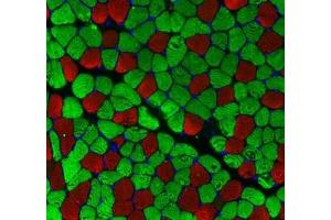 Immunofluorescent analysis of paraformaldehyde-fixed mouse skeletal muscle using MYH1 (, red) and MYH7 (ABIN7075623, green) at dilution of 1: 100