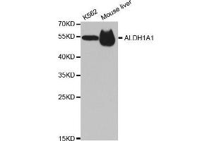 Western blot analysis of extracts of various cell lines, using ALDH1A1 antibody. (ALDH1A1 抗体  (AA 48-147))