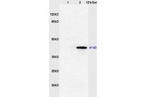 FOXE1 抗体  (AA 101-200)
