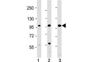 Western Blotting (WB) image for anti-Colony Stimulating Factor 1 Receptor (CSF1R) (AA 895-923) antibody (ABIN3028575)