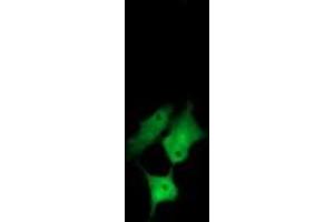 Image no. 2 for anti-Chaperonin Containing TCP1, Subunit 8 (Theta)-Like 2 (CCT8L2) antibody (ABIN1497480) (CCT8L2 抗体)