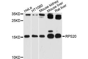 Western blot analysis of extracts of various cell lines, using RPS20 antibody (ABIN4905052) at 1:1000 dilution. (RPS20 抗体)
