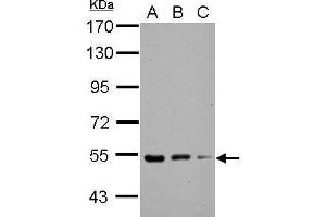 WB Image Sample (30 ug of whole cell lysate) A: NIH-3T3 B: JC C: BCL-1 7. (KBTBD4 抗体  (Center))