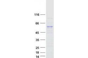 Western Blotting (WB) image for Methyltransferase Like 4 (METTL4) protein (Myc-DYKDDDDK Tag) (ABIN2725893)