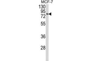 Western Blotting (WB) image for anti-Mitogen-Activated Protein Kinase 8 Interacting Protein 1 (MAPK8IP1) antibody (ABIN3004004)