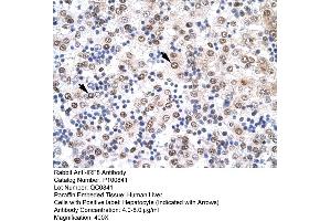 Immunohistochemistry with Human Liver cell lysate tissue (IRF8 抗体  (N-Term))