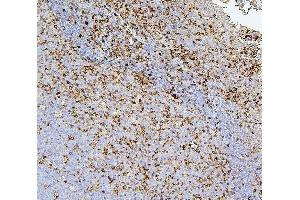 IHC analysis of CD43 using anti-CD43 antibody (ABIN7601042). (CD43 抗体  (AA 272-400))