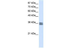Western Blotting (WB) image for anti-Calcium Channel, Voltage-Dependent, gamma Subunit 4 (CACNG4) (N-Term) antibody (ABIN630108)