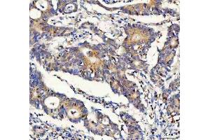 IHC analysis of FOXO3A using anti-FOXO3A antibody (ABIN3042404). (FOXO3 抗体  (AA 471-673))