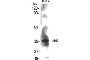 Western Blot (WB) analysis of specific cells using AIM2 Polyclonal Antibody. (AIM2 抗体  (Internal Region))
