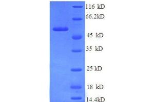 SDS-PAGE (SDS) image for Hemopexin (HPX) (AA 24-460), (full length) protein (His tag) (ABIN7479084)