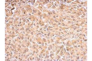 IHC-P Image HSP70 1A antibody detects HSPA1A protein at cytosol on H1299 xenograft by immunohistochemical analysis. (HSP70 1A 抗体  (Center))