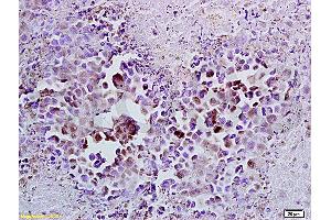 Formalin-fixed and paraffin embedded mouse lymphoma tissue labeled with Anti-Cyclin A2 Polyclonal Antibody (ABIN670281), Unconjugated at 1:100, followed by conjugation to the secondary antibody and DAB staining (Cyclin A 抗体  (AA 375-431))