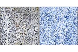 Immunohistochemistry analysis of paraffin-embedded human tonsil tissue, using RPL23 Antibody. (RPL23 抗体  (AA 51-100))