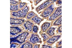 IHC analysis of NMU using anti-NMU antibody (ABIN5692905). (Neuromedin U 抗体)
