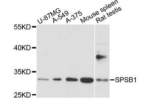 Western blot analysis of extracts of various cell lines, using SPSB1 antibody (ABIN6293888) at 1:1000 dilution.