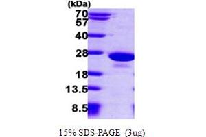 SDS-PAGE (SDS) image for Protein Tyrosine Phosphatase Type IVA, Member 1 (PTP4A1) (AA 1-170) protein (His tag) (ABIN666803) (PTP4A1 Protein (AA 1-170) (His tag))