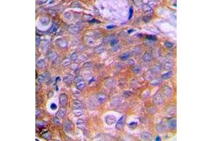 Immunohistochemistry (IHC) image for anti-Cortactin (CTTN) (C-Term) antibody (ABIN7297912)