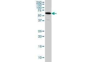 NDOR1 monoclonal antibody (M01A), clone 3A11 Western Blot analysis of NDOR1 expression in HeLa . (NDOR1 抗体  (AA 498-595))